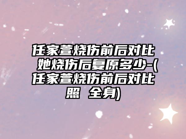 任家萱燒傷前后對比 她燒傷后復原多少-(任家萱燒傷前后對比照 全身)