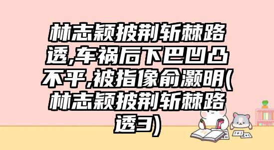 林志穎披荊斬棘路透,車(chē)禍后下巴凹凸不平,被指像俞灝明(林志穎披荊斬棘路透3)